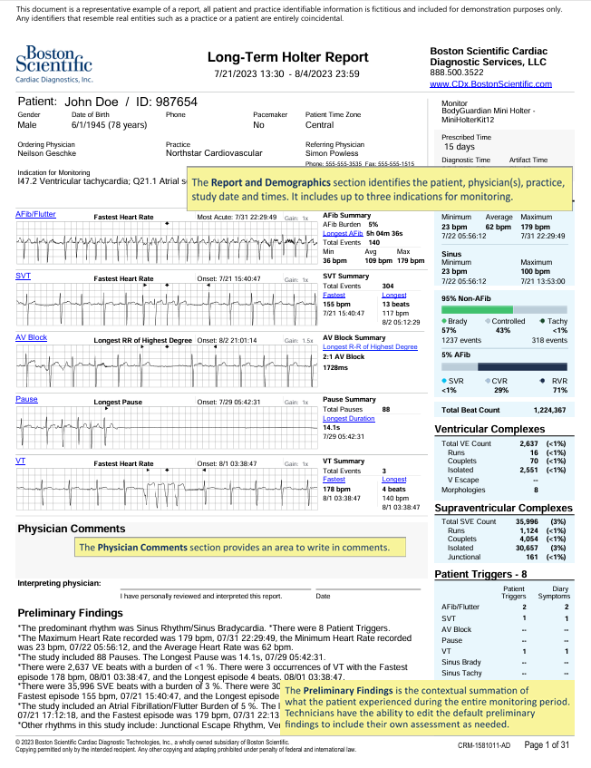 Long-term holter report example showing demographics, physician comments, and preliminary findings.