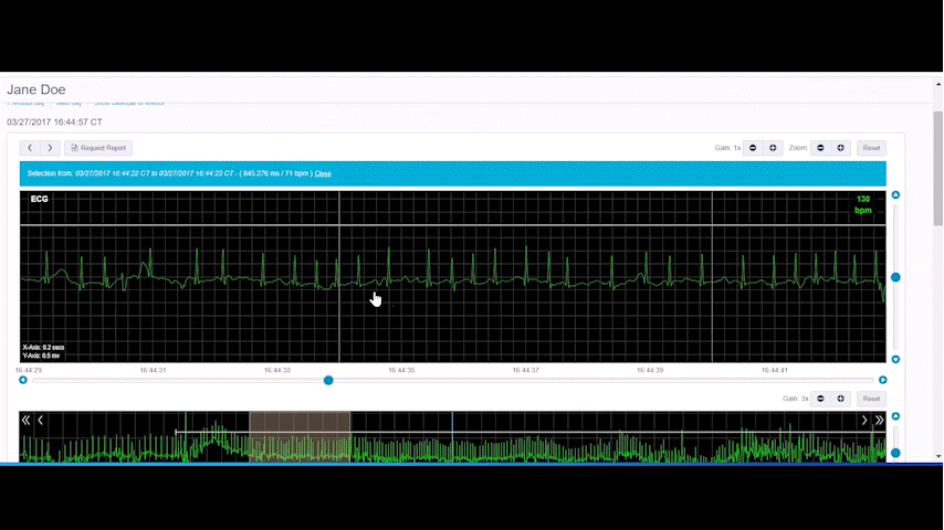 GIF showing the ECG Insight platfrom showing a patient's full picture.