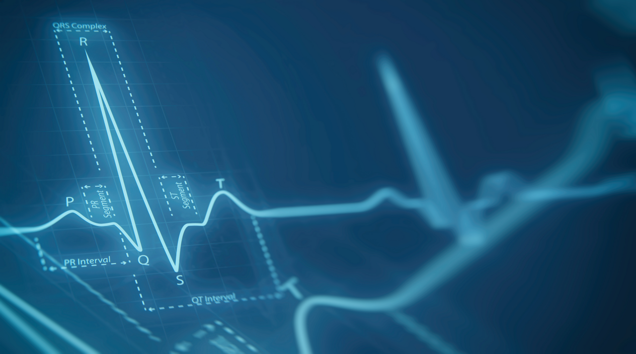 ECG snippet image on blue background representing the ECG Insight feature of BodyGuardian.