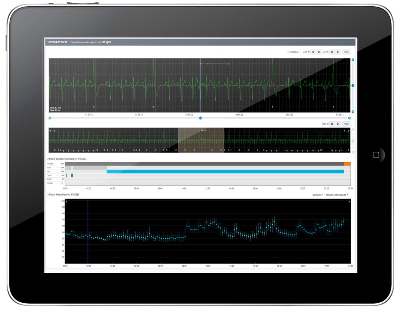 Tablet screen showing heart rhythm data strips in the ECG Insight system.