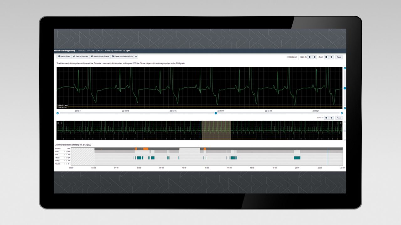 Computer monitor with data from BodyGuardian Remote Cardiac Monitor.