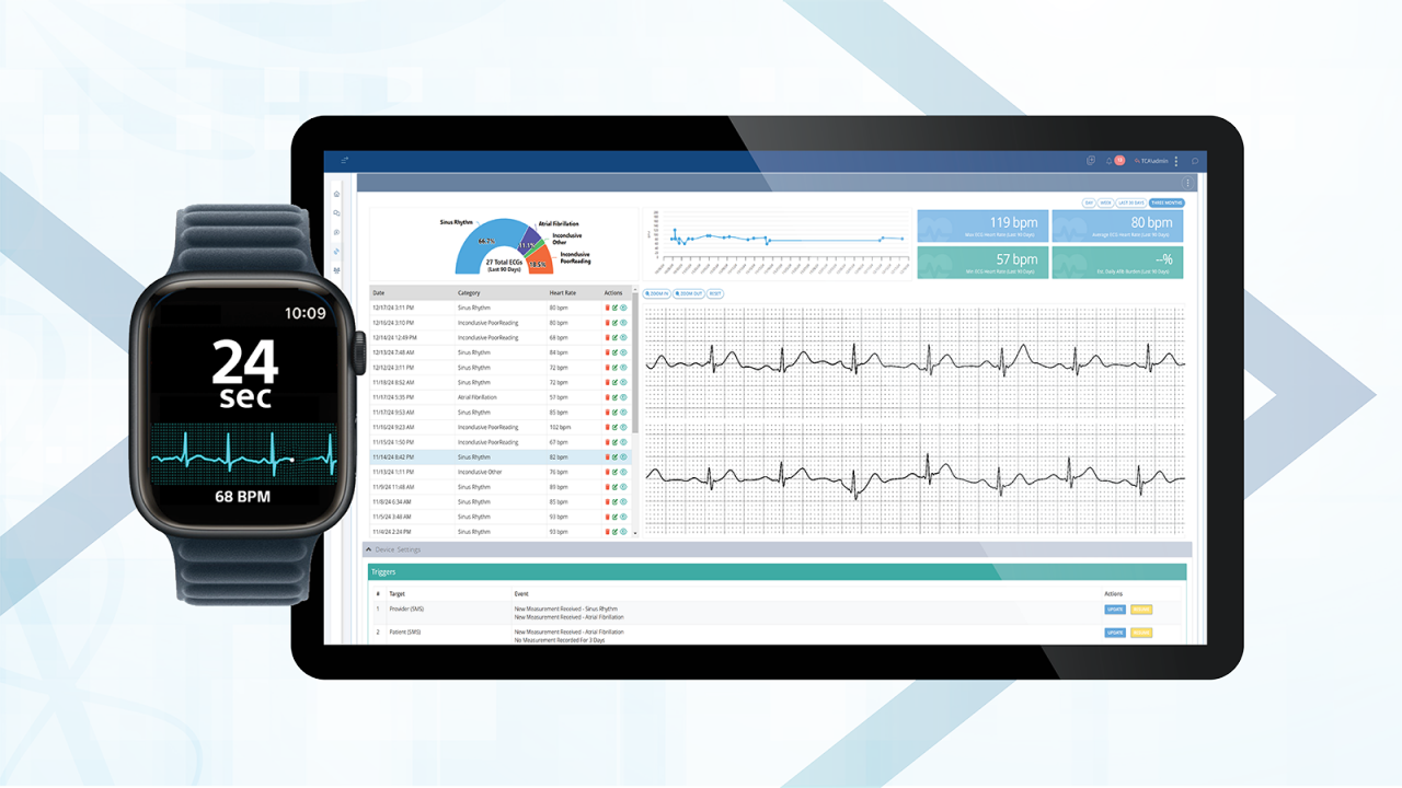 Computer screen showing the BodyGuardian 360 software next to a smart watch.